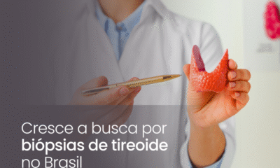 Cresce a busca por biópsias de tireoide no Brasil
