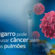 Cigarro pode causar câncer além dos pulmões