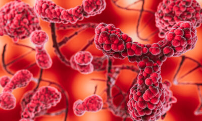 ANS avalia inclusão de tratamento para mielofibrose no rol